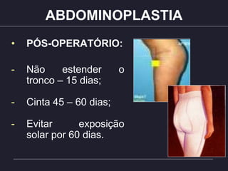 ABDOMINOPLASTIA
• PÓS-OPERATÓRIO:
- Não estender o
tronco – 15 dias;
- Cinta 45 – 60 dias;
- Evitar exposição
solar por 60 dias.
 