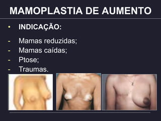 MAMOPLASTIA DE AUMENTO
• INDICAÇÃO:
- Mamas reduzidas;
- Mamas caídas;
- Ptose;
- Traumas.
 