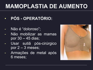 MAMOPLASTIA DE AUMENTO
• PÓS - OPERATÓRIO:
- Não é “doloroso”;
- Não mobilizar as mamas
por 30 – 45 dias;
- Usar sutiã pós-cirúrgico
por 2 – 3 meses;
- Armações de metal após
6 meses;
 
