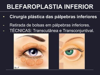 BLEFAROPLASTIA INFERIOR
• Cirurgia plástica das pálpebras inferiores
- Retirada de bolsas em pálpebras inferiores.
- TÉCNICAS: Transcutânea e Transconjuntival.
 