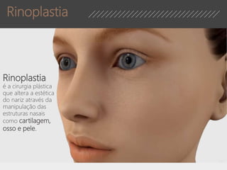 Rinoplastia
é a cirurgia plástica
que altera a estética
do nariz através da
manipulação das
estruturas nasais
como cartilagem,
osso e pele.
Rinoplastia
 
