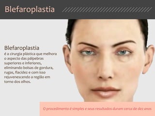 Blefaroplastia
O procedimento é simples e seus resultados duram cerca de dez anos
Blefaroplastia
é a cirurgia plástica que melhora
o aspecto das pálpebras
superiores e inferiores,
eliminando bolsas de gordura,
rugas, flacidez e com isso
rejuvenescendo a região em
torno dos olhos.
 