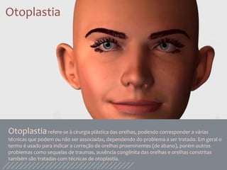 Otoplastia
Otoplastiarefere-se à cirurgia plástica das orelhas, podendo corresponder a várias
técnicas que podem ou não ser associadas, dependendo do problema a ser tratado. Em geral o
termo é usado para indicar a correção de orelhas proeminentes (de abano), porém outros
problemas como sequelas de traumas, ausência congênita das orelhas e orelhas constritas
também são tratadas com técnicas de otoplastia.
 