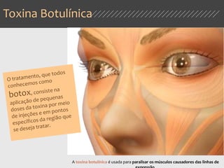 Toxina Botulínica
A toxina botulínica é usada para paralisar os músculos causadores das linhas de
 
