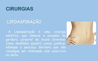 CIRURGIAS
LIPOASPIRAÇÃO
A Lipoaspiração é uma cirurgia
estética, que remove o excesso de
gordura corporal de locais diversos,
como: abdômen, quadril, coxas, joelhos,
nádegas e pescoço. Gordura que não
consegue ser eliminada com exercício
ou dieta.
 
