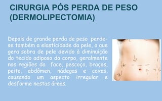 CIRURGIA PÓS PERDA DE PESO
(DERMOLIPECTOMIA)
Depois de grande perda de peso perde-
se também a elasticidade da pele, o que
gera sobra de pele devido à diminuição
do tecido adiposo do corpo, geralmente
nas regiões da face, pescoço, braços,
peito, abdômen, nádegas e coxas,
causando um aspecto irregular e
desforme nestas áreas.
 