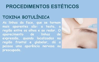 PROCEDIMENTOS ESTÉTICOS
TOXINA BOTULÍNICA
As linhas da face, que se tornam
mais aparentes são: a testa, a
região entre os olhos e ao redor. O
aparecimento de linhas de
expressão, quando localizadas na
região frontal e glabelar, dá a
pessoa uma aparência nervosa ou
preocupada.
 
