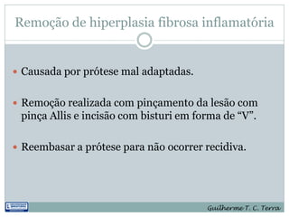 Remoção de hiperplasia fibrosa inflamatória


 Causada por prótese mal adaptadas.


 Remoção realizada com pinçamento da lesão com
 pinça Allis e incisão com bisturi em forma de “V”.

 Reembasar a prótese para não ocorrer recidiva.




                                        Guilherme T. C. Terra
 