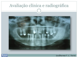 Avaliação clínica e radiográfica




                         Guilherme T. C. Terra
 