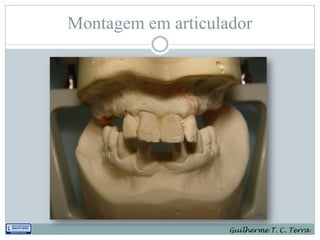 Montagem em articulador




                    Guilherme T. C. Terra
 