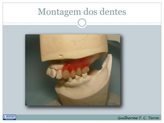 Montagem dos dentes




                 Guilherme T. C. Terra
 
