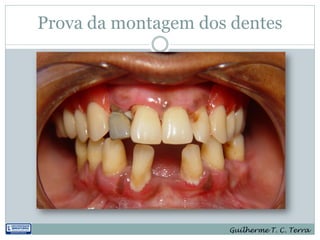 Prova da montagem dos dentes




                     Guilherme T. C. Terra
 