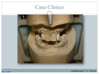 Caso Clínico




               Guilherme T. C. Terra
 