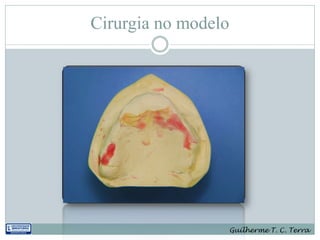 Cirurgia no modelo




                     Guilherme T. C. Terra
 