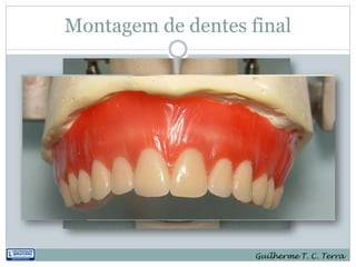 Montagem de dentes final




                    Guilherme T. C. Terra
 