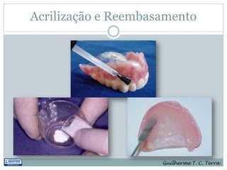 Acrilização e Reembasamento




                     Guilherme T. C. Terra
 