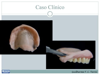 Caso Clínico




               Guilherme T. C. Terra
 