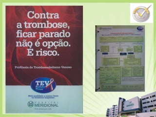 Incidência de dor pós-operatória:                    cirurgia ambulatorial1Escala de dor  - 0 a 1065%7060Dor moderada < 45045%40%Dor  Intensa > 440Pacientes (%)26%3024%2013%10024 horas48 horasDia 7Tempo após a alta1Beauregard L et al. Can J Anaesth. 1998;45:304-311.
