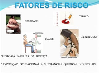 TABACO
OBESIDADE
HIPERTENSÃO
DIÁLISE
*HISTÓRIA FAMILIAR DA DOENÇA
* EXPOSIÇÃO OCUPACIONAL À SUBSTÂNCIAS QUÍMICAS INDUSTRIAIS.
 