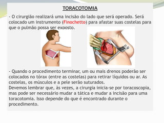 TORACOTOMIA
- O cirurgião realizará uma incisão do lado que será operado. Será
colocado um instrumento (Finochetto) para afastar suas costelas para
que o pulmão possa ser exposto.




- Quando o procedimento terminar, um ou mais drenos poderão ser
colocados no tórax (entre as costelas) para retirar líquidos ou ar. As
costelas, os músculos e a pele serão suturados.
Devemos lembrar que, às vezes, a cirurgia inicia-se por toracoscopia,
mas pode ser necessário mudar a tática e mudar a incisão para uma
toracotomia. Isso depende do que é encontrado durante o
procedimento.
 