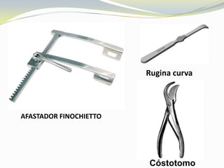 Rugina curva



AFASTADOR FINOCHIETTO




                        Cóstotomo
 