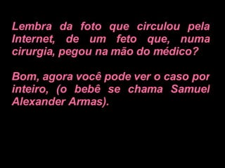 Lembra da foto que circulou pela Internet, de um feto que, numa cirurgia, pegou na mão do médico?  Bom, agora você pode ver o caso por inteiro, (o bebê se chama Samuel Alexander Armas).   