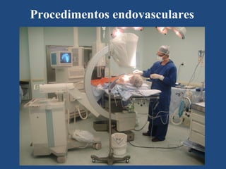 Procedimentos endovasculares
 