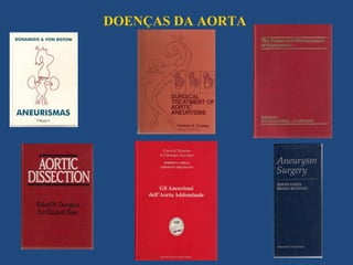 DOENÇAS DA AORTA
 