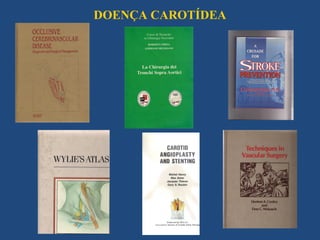 DOENÇA CAROTÍDEA
 