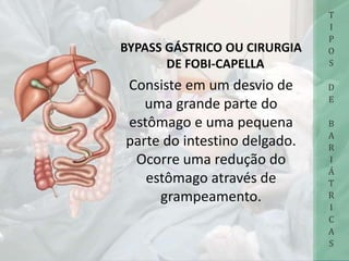 BYPASS GÁSTRICO OU CIRURGIA
DE FOBI-CAPELLA
Consiste em um desvio de
uma grande parte do
estômago e uma pequena
parte do intestino delgado.
Ocorre uma redução do
estômago através de
grampeamento.
T
I
P
O
S
D
E
B
A
R
I
Á
T
R
I
C
A
S
 