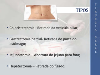 TIPOS
• Colecistectomia –Retirada da vesícula biliar;
• Gastrectomia parcial- Retirada de parte do
estômago;
• Jejunostomia – Abertura do jejuno para fora;
• Hepatectomia – Retirada do fígado.
C
I
R
U
R
G
I
A
G
E
R
A
L
 