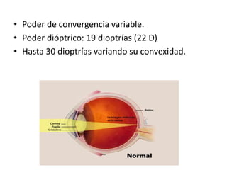 • Poder de convergencia variable.
• Poder dióptrico: 19 dioptrías (22 D)
• Hasta 30 dioptrías variando su convexidad.
 