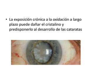 • La exposición crónica a la oxidación a largo
plazo puede dañar el cristalino y
predisponerlo al desarrollo de las cataratas
 