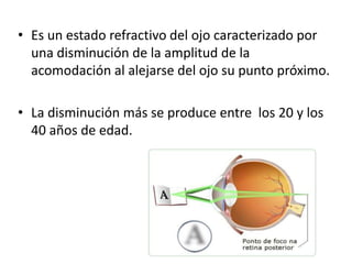 • Es un estado refractivo del ojo caracterizado por
una disminución de la amplitud de la
acomodación al alejarse del ojo su punto próximo.
• La disminución más se produce entre los 20 y los
40 años de edad.
 