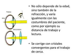 • No sólo depende de la edad,
sino también de la
refracción, y varía
igualmente con las
costumbres del paciente,
como por ejemplo su
distancia de trabajo y
lectura.
• Se corrige con cristales
convergentes para el trabajo
de cerca.
 