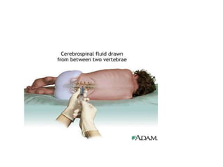 Cisterns 19 4 dr. chandra