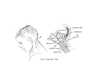 Cisterns 19 4 dr. chandra