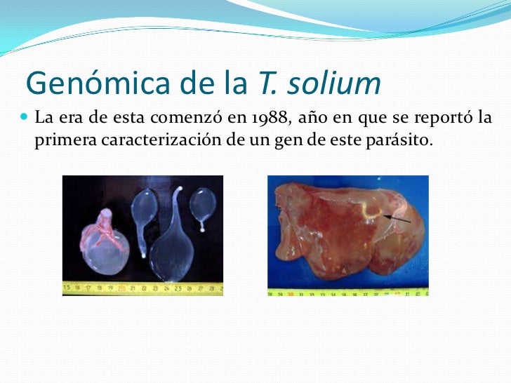 tratamientos de perdida de peso y volumen Elegir buenas tratamientos de perdida de peso y volumen primer lugar entre