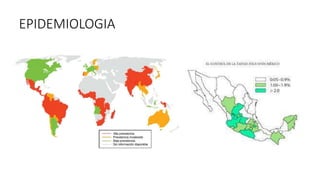 EPIDEMIOLOGIA
 