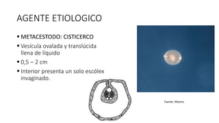AGENTE ETIOLOGICO
 METACESTODO: CISTICERCO
 Vesícula ovalada y translúcida
llena de líquido
 0,5 – 2 cm
 Interior presenta un solo escólex
invaginado.
Fuente: Mestra
 