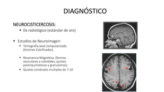 NEUROCISTICERCOSIS:
 Dx radiológico (estándar de oro)
 Estudios de Neuroimagen:
 Tomografía axial computarizada.
(lesiones Calcificadas).
 Resonancia Magnética. (formas
vesiculares y coloidales; quistes
parenquimatosos y granulomas).
 Quistes cerebrales multiples de 7-10
DIAGNÓSTICO
 