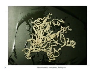 Cisticercosis parasitosis intestinal