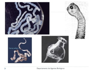 Cisticercosis parasitosis intestinal