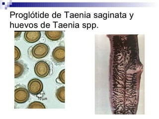 Cisticercosis parasitosis intestinal