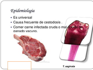 Cisticercosis parasitosis intestinal