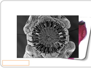 Cisticercosis parasitosis intestinal