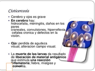 Cisticercosis parasitosis intestinal