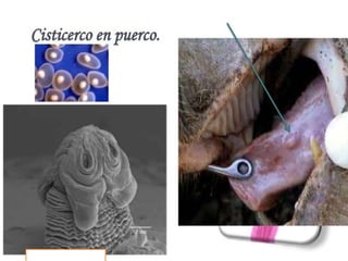 Cisticercosis parasitosis intestinal