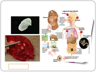 Cisticercosis parasitosis intestinal