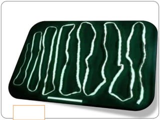 Cisticercosis parasitosis intestinal